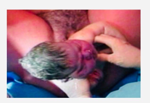 How To Handle And Manage First And Second Stages Of Labour As A Midwife Nurse How To Handle And Manage First And Second Stages Of Labour As A Midwife Nurse