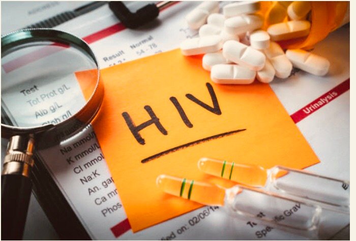 HIV and AIDS: Nursing Course Notes HIV and AIDS: Nursing Course Notes
